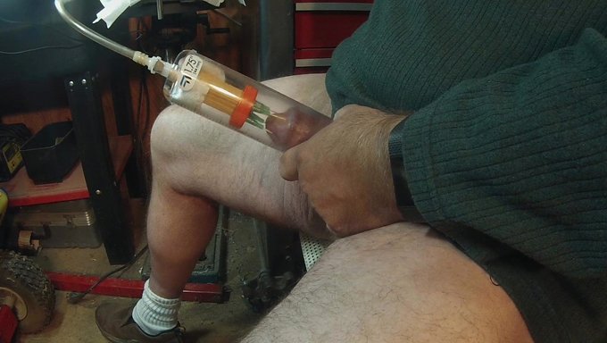 Hombre Atrapado Con Agujas En Su Pene